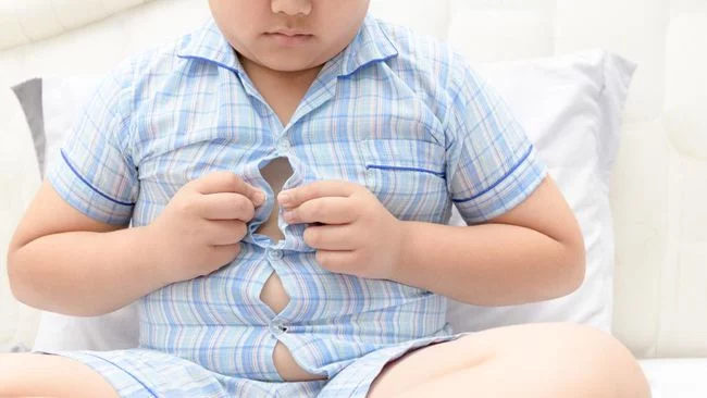 Hati-hati, Anak Gemuk Memang Menggemaskan Tapi Bisa Obesitas